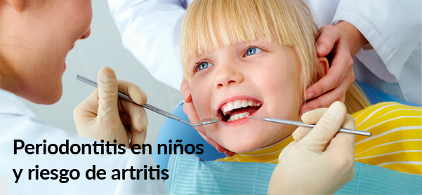 Periodontitis en niños y riesgo de artritis