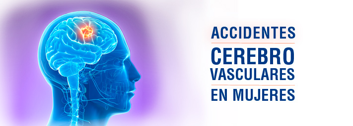 Accidentes cerebrovasculares en mujeres