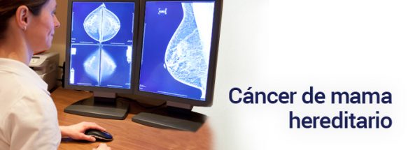 cancer de mama hereditario