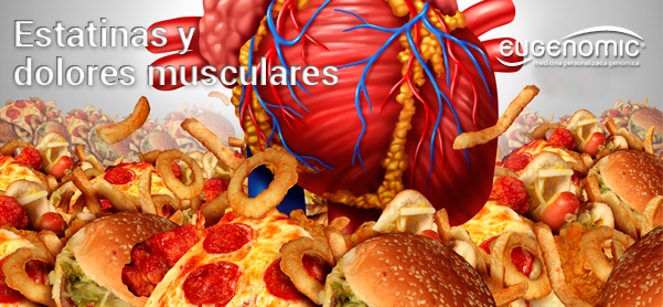 Estatinas y dolores musculares