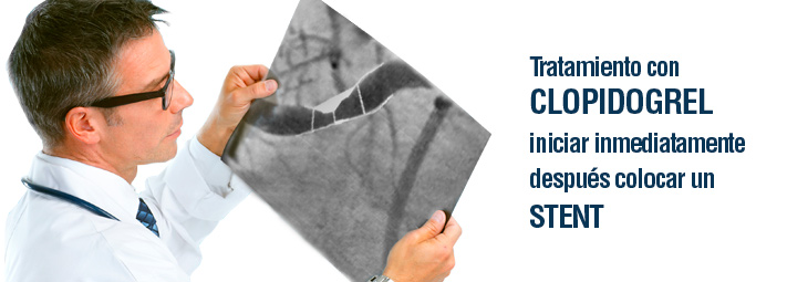 Tratamiento con clopidrogrel iniciar inmediatamente después de colocar stent