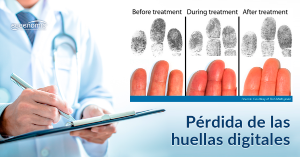 perdida-huellas-digitales-fb